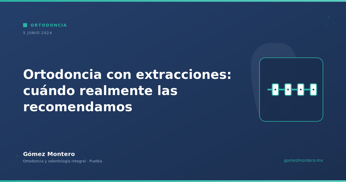 Ortodoncia con extracciones: cuándo realmente las recomendamos