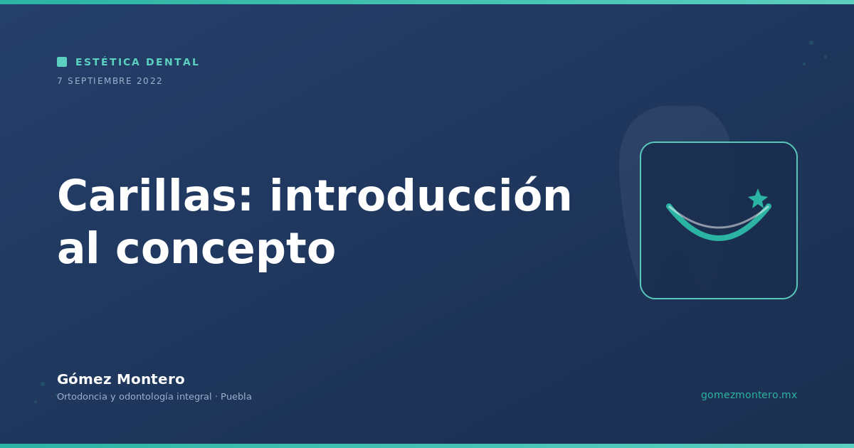 Carillas: introducción al concepto