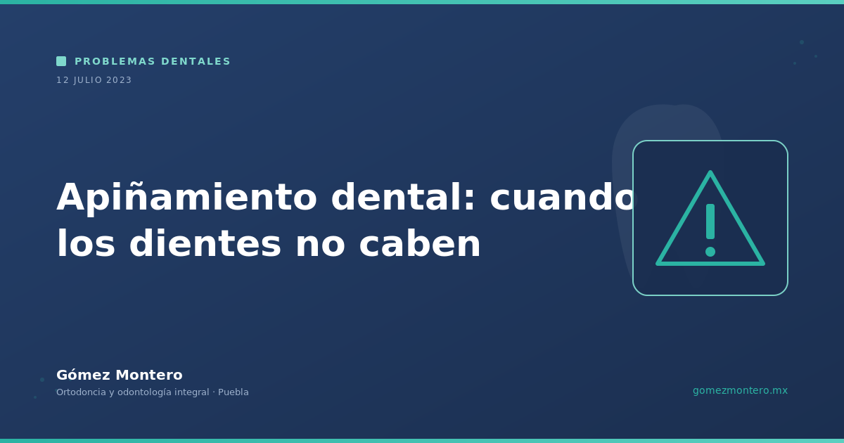Apiñamiento dental: cuando los dientes no caben