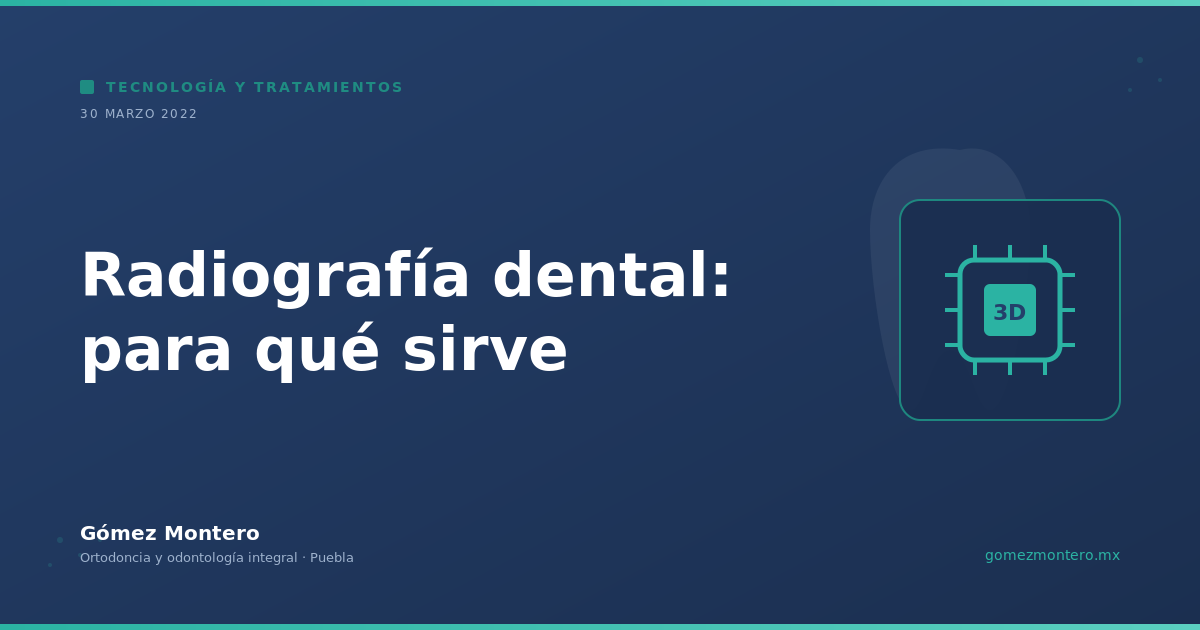 Radiografía dental: para qué sirve