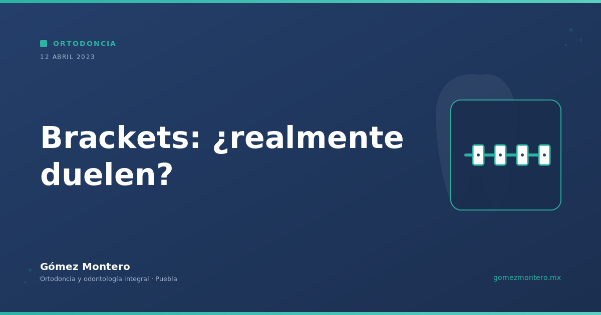 Brackets: ¿realmente duelen?