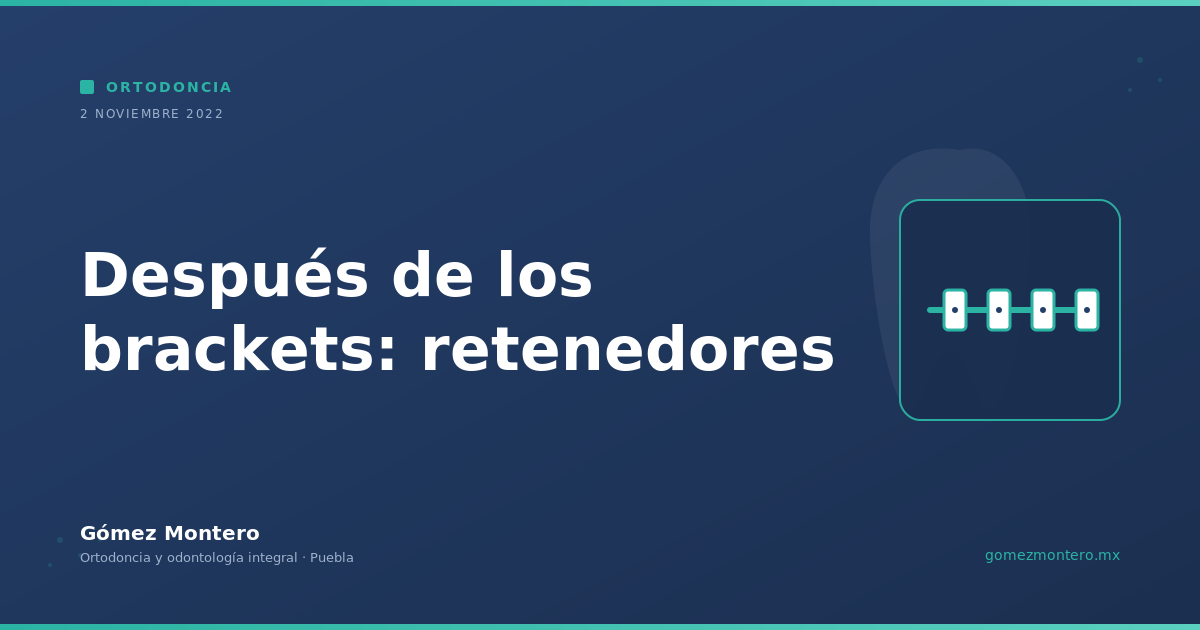 Después de los brackets: retenedores