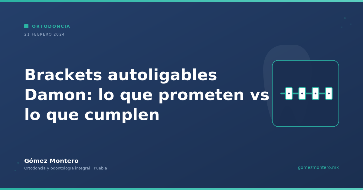 Brackets autoligables Damon: lo que prometen vs lo que cumplen