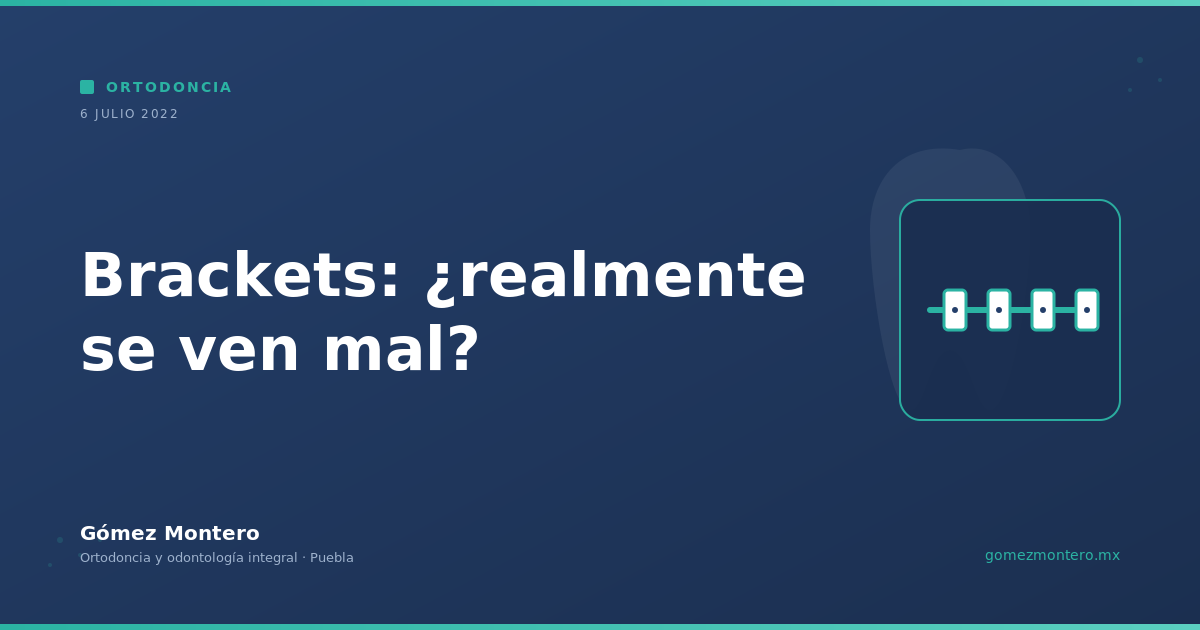 Brackets: ¿realmente se ven mal?