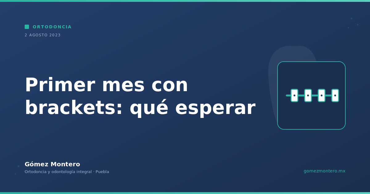 Primer mes con brackets: qué esperar