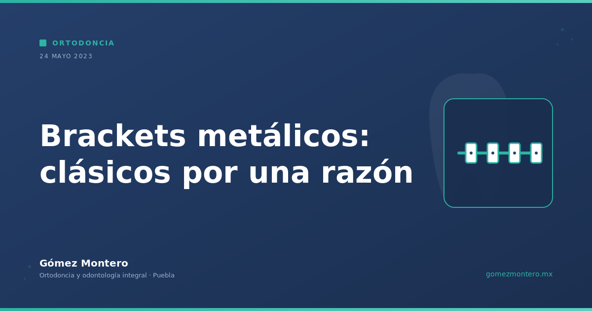 Brackets metálicos: clásicos por una razón