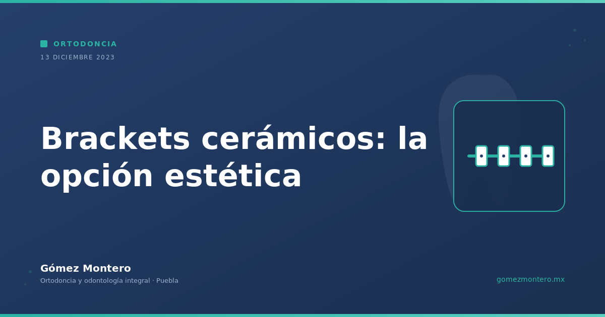 Brackets cerámicos: la opción estética