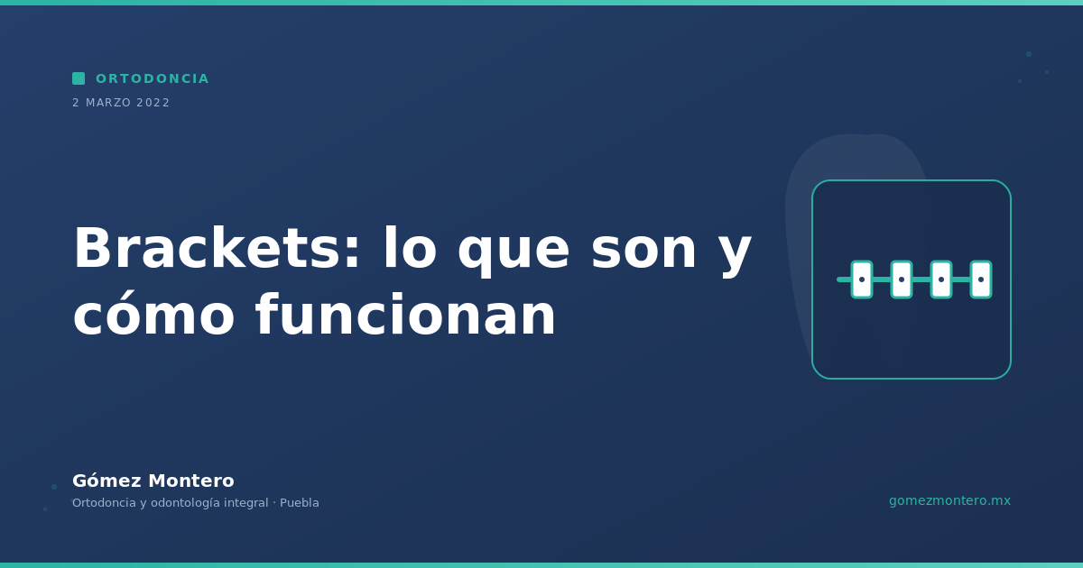 Brackets: lo que son y cómo funcionan