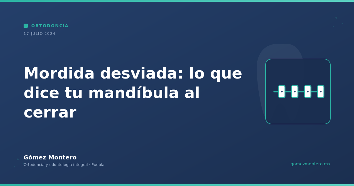 Mordida desviada: lo que dice tu mandíbula al cerrar