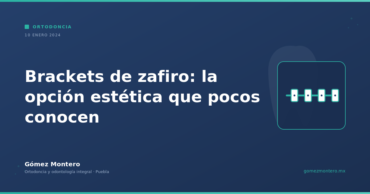 Brackets de zafiro: la opción estética que pocos conocen