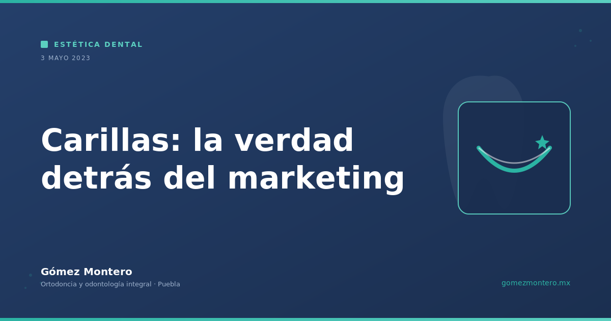 Carillas: la verdad detrás del marketing